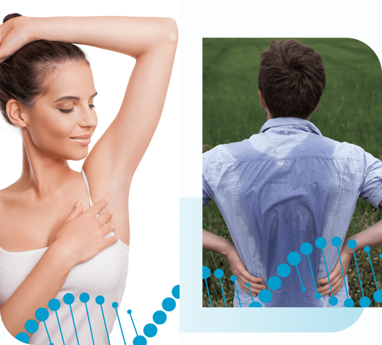 Excessive Sweating (hyperhidrosis) treatments at Hollywood Dermatology