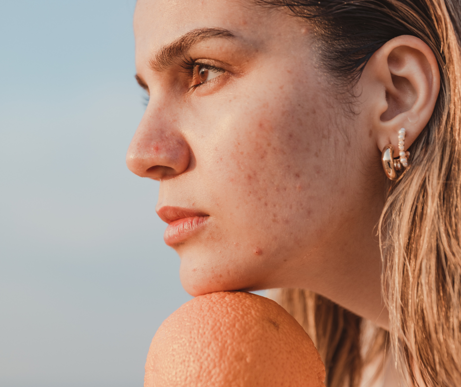 Facebook Posts-Karrinyup Dermatology