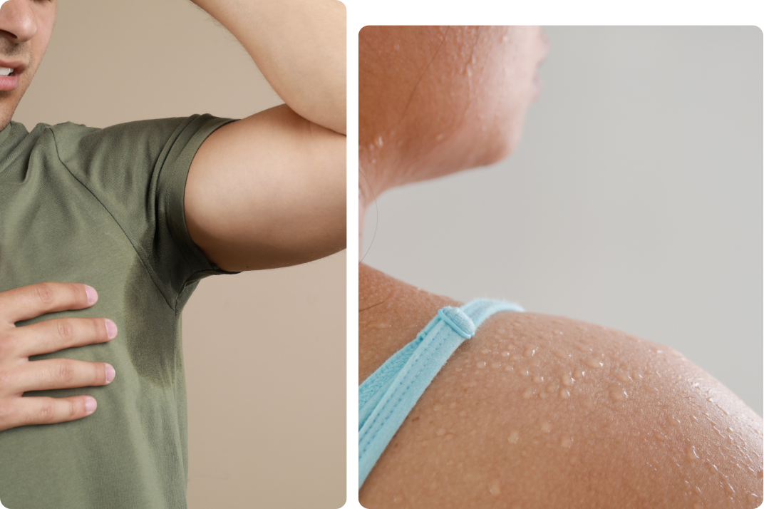 Karrinyup- Website Banner hyperhidrosis
